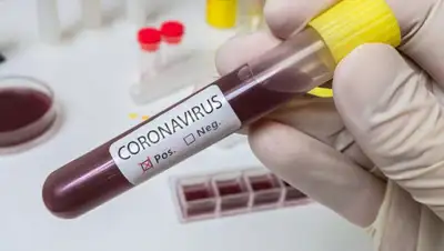 vyatka-grad.ru, фото - Новости Zakon.kz от 05.04.2020 09:17