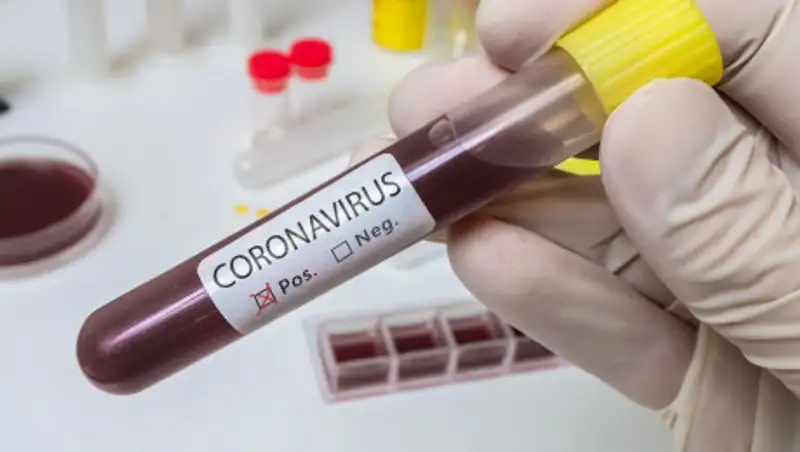 Количество случаев заражения коронавирусом в Казахстане достигло 551