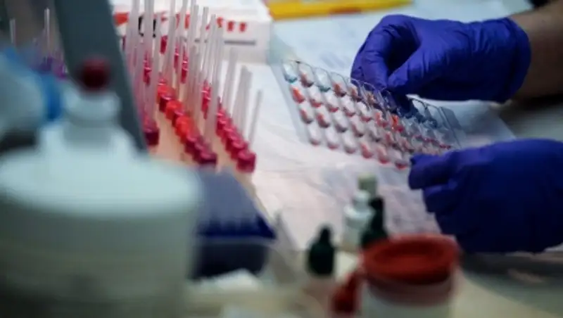 Дизентерия и сальмонеллез выявлены у отравившихся на отдыхе детей в СКО