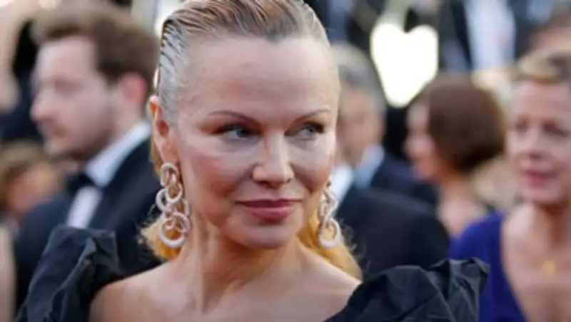 Памела Андерсон перестаралась с пластикой