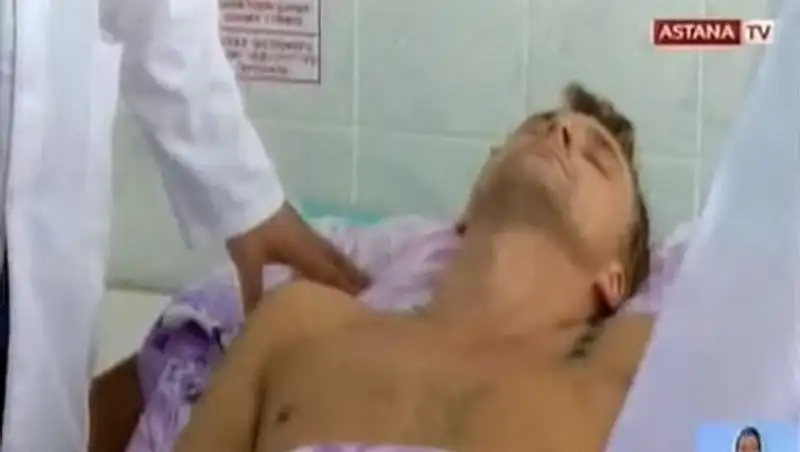 Павлодарские хирурги пришили мужчине оторванную руку