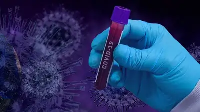 В Казахстане 69 человек за сутки заболели коронавирусом, фото - Новости Zakon.kz от 01.02.2023 08:42