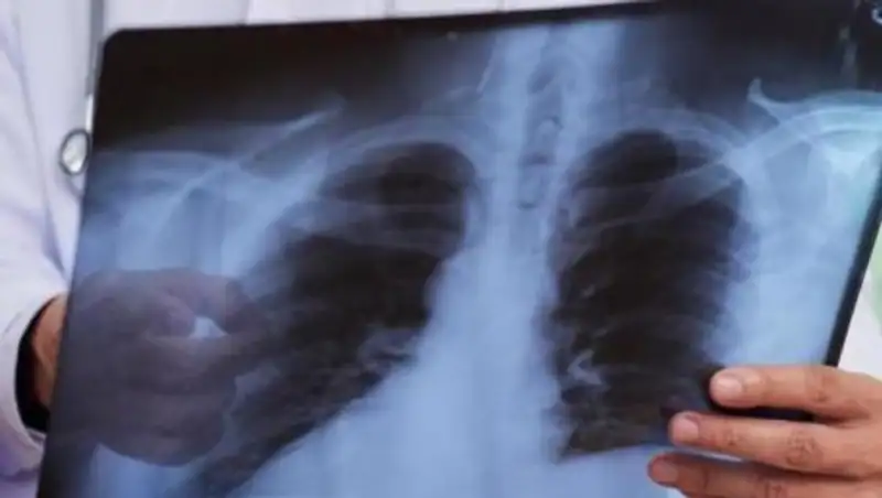 Более 2000 работников Тенгизшевройла заболели коронавирусом