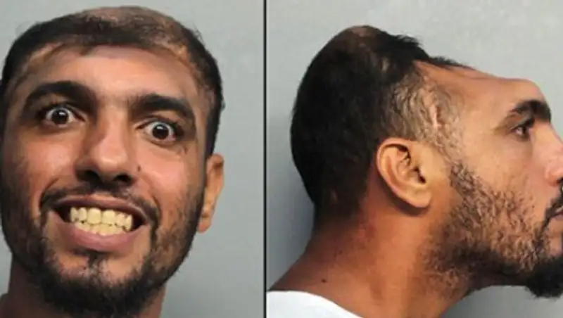 Американца с половиной головы арестовали за попытку убийства путем поджога матраса