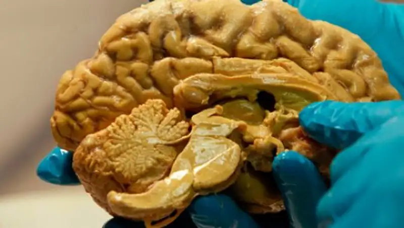 Разгадана главная тайна человеческого мозга