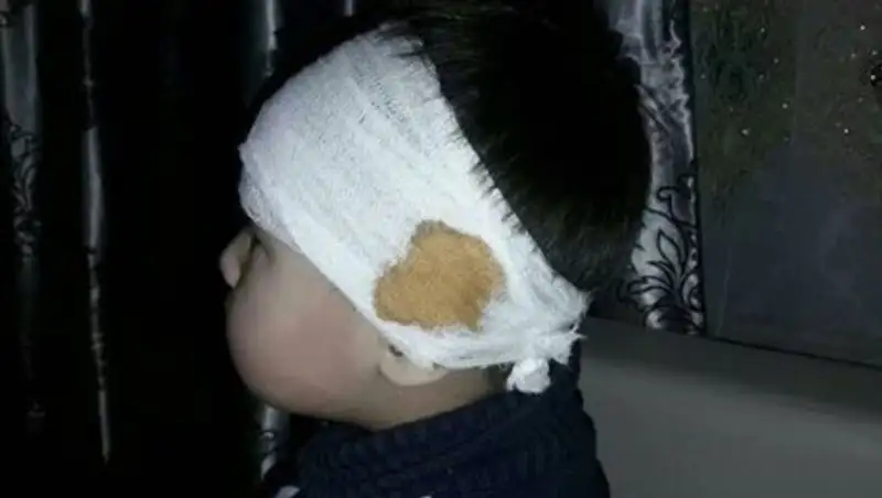 В Караганде парикмахер порезала ухо ребенку