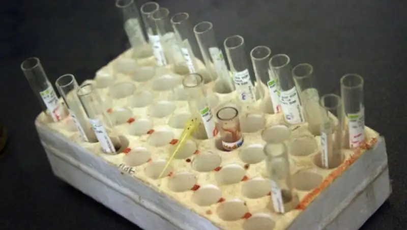 ЮНИСЕФ: смертность от ВИЧ среди подростков возросла втрое за 15 лет