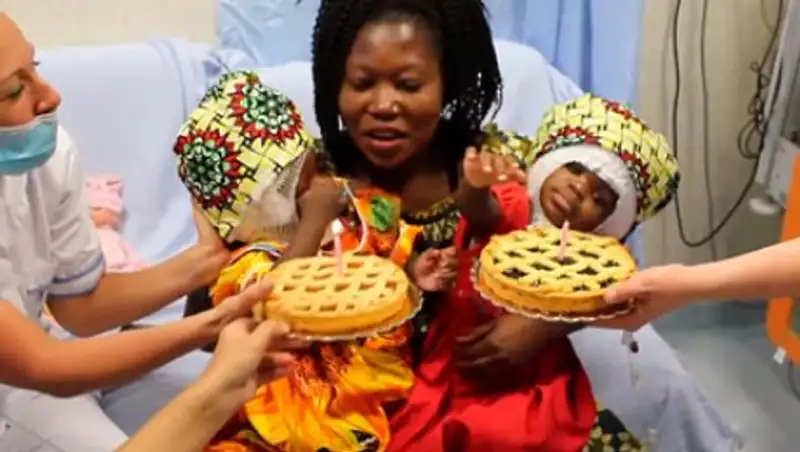 Врачи разделили сросшихся головами сестер