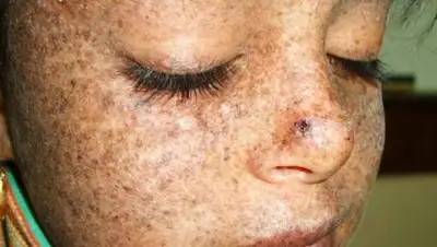 IaKosmetolog.ru, фото - Новости Zakon.kz от 13.03.2018 07:50