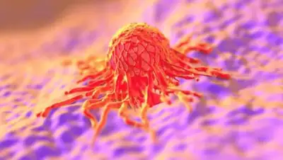 Zakon.kz, фото - Новости Zakon.kz от 04.09.2017 15:13