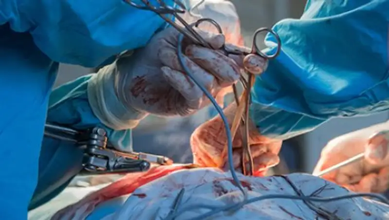 Ирландскому подростку пришили ногу задом наперед