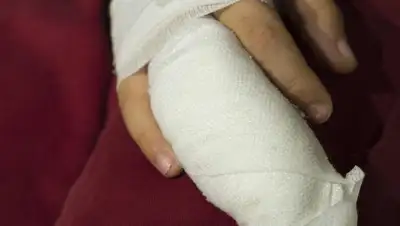 Подростку отрезало палец , фото - Новости Zakon.kz от 03.08.2022 01:44