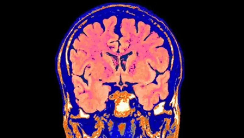 В США решили оживить мертвый мозг человека