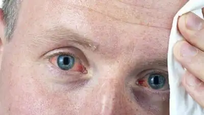 из открытых источников, фото - Новости Zakon.kz от 01.02.2019 17:51