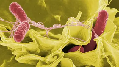 плотоядная бактерия, фото - Новости Zakon.kz от 30.09.2023 10:53
