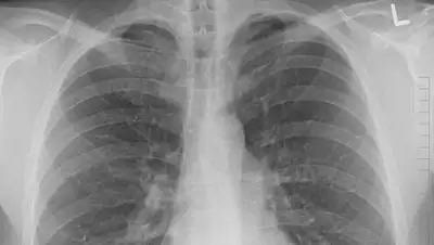 wikipedia.org, фото - Новости Zakon.kz от 09.11.2020 16:28