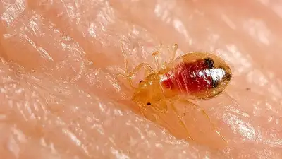 Клопы в Париже, фото - Новости Zakon.kz от 02.10.2023 12:58