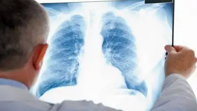 24.kz, фото - Новости Zakon.kz от 30.10.2020 09:18