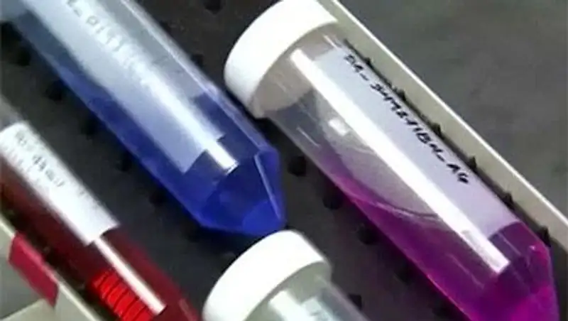 Вакцина против Эболы: побочных реакций не выявлено