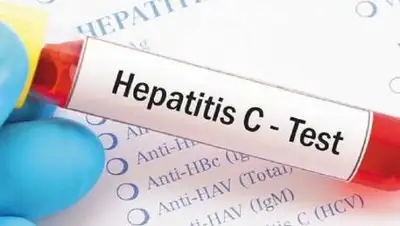 pixabay.com, фото - Новости Zakon.kz от 07.07.2021 14:35