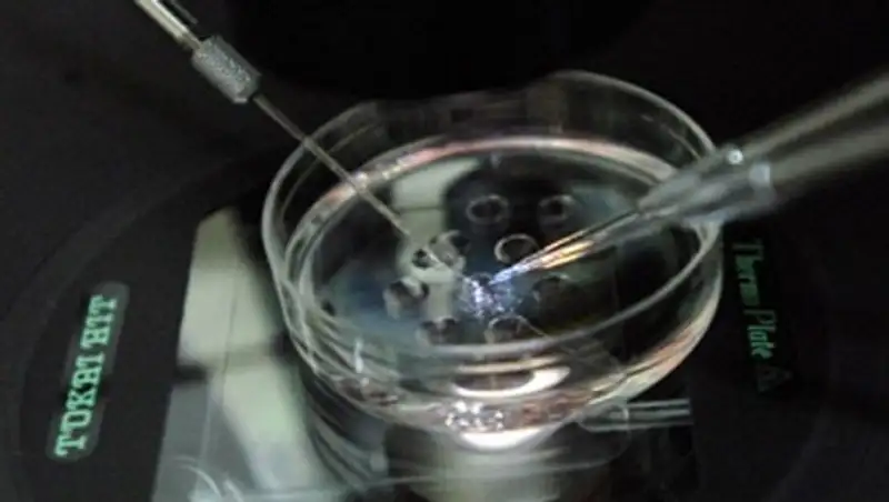 Японские ученые первыми в мире смогли искусственно получить базовый элемент почечной ткани