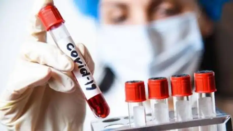 COVID-19 подтвердился у 2883 человек за сутки в Казахстане