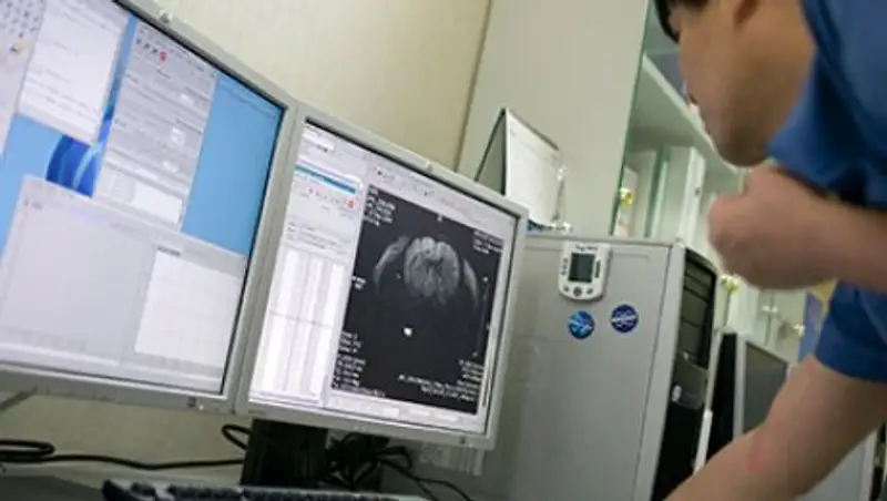 Найден способ избавиться от воспоминаний