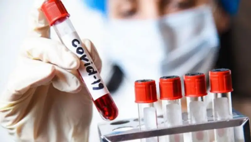 Еще 929 казахстанцев  вылечились от коронавируса