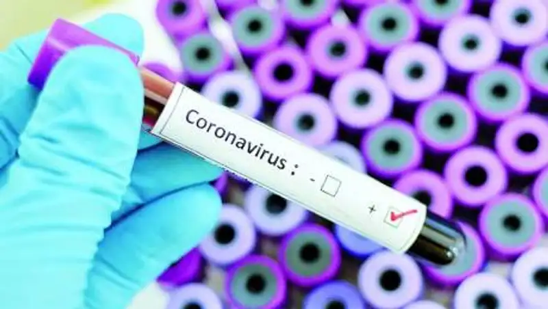 37 казахстанцев скончались от коронавируса за неделю