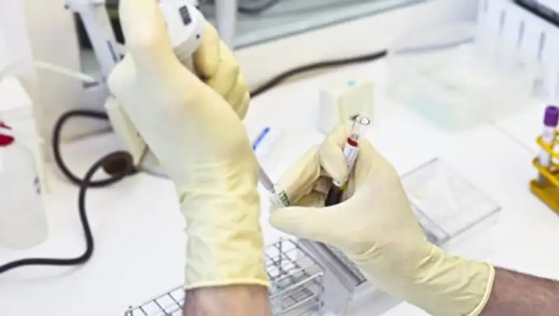 Среди геев Европы зафикисрована вспышка гепатита А