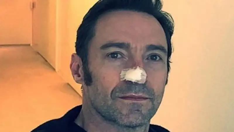 Голливудский актёр Хью Джекман вновь борется с раком кожи