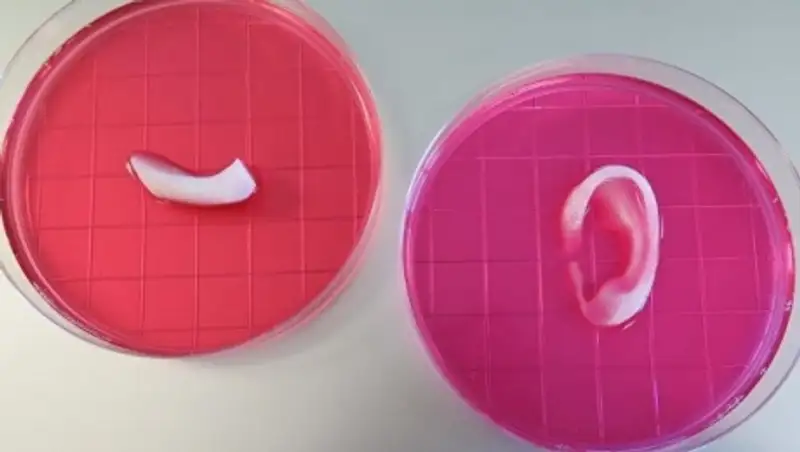 Ученые создали 3D-принтер для печати человеческих костей и мышц