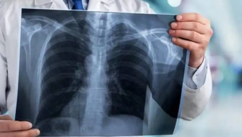 Еще 12 казахстанцев скончались от коронавирусной инфекции