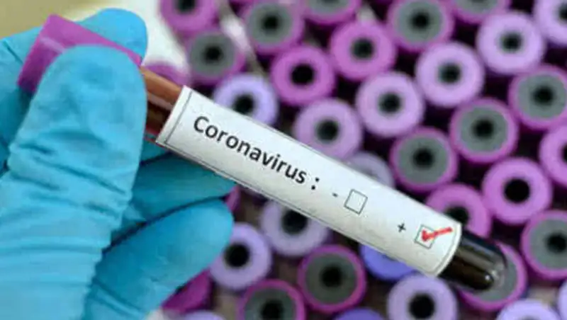 За сутки в Казахстане выявили 77 зараженных COVID-19