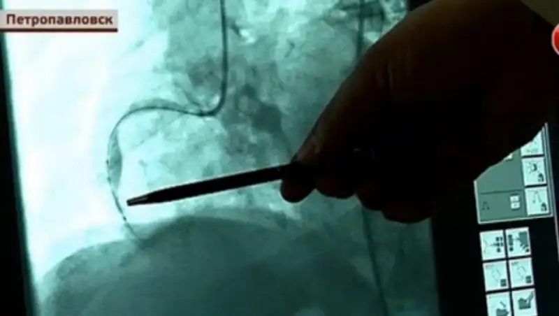 В кардиоцентре Петропавловска готовы к сложнейшим операциям