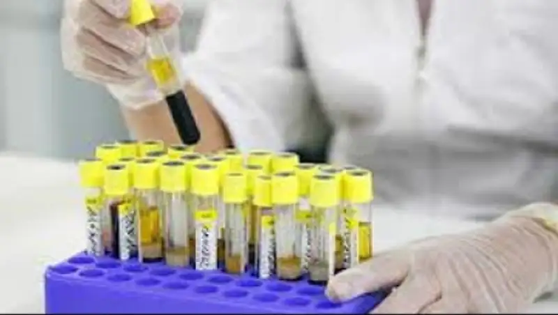 В Жамбылской области у 2 человек обнаружен вирус конго-крымской геморрагической лихорадки