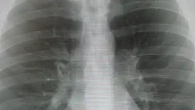 wikipedia.org, фото - Новости Zakon.kz от 13.01.2020 09:56