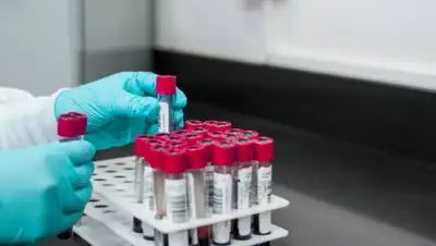 pixabay.com, фото - Новости Zakon.kz от 28.06.2021 15:57