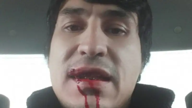 В Узбекистане блогеру порвали рот