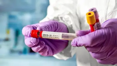 coronavirus2020.kz, фото - Новости Zakon.kz от 10.08.2020 09:05