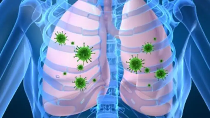 В Казахстане в 2 раза снижена  заболеваемость туберкулезом