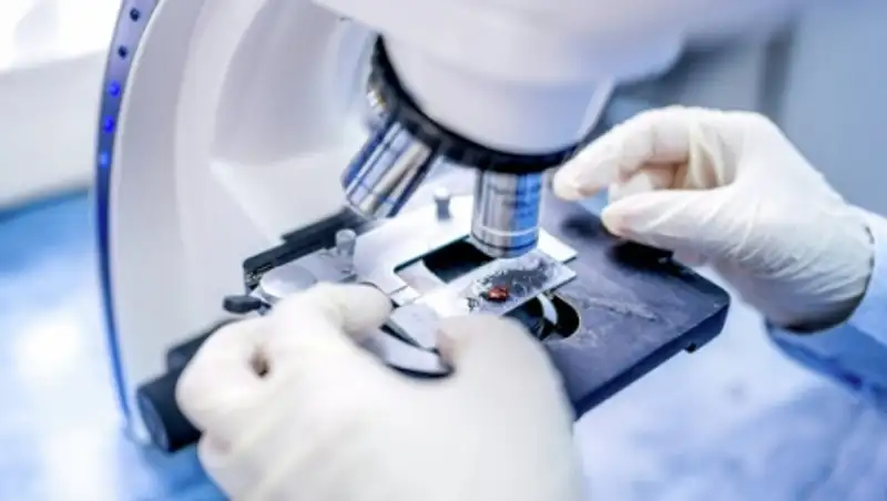 Ученые обнаружили ген инсульта