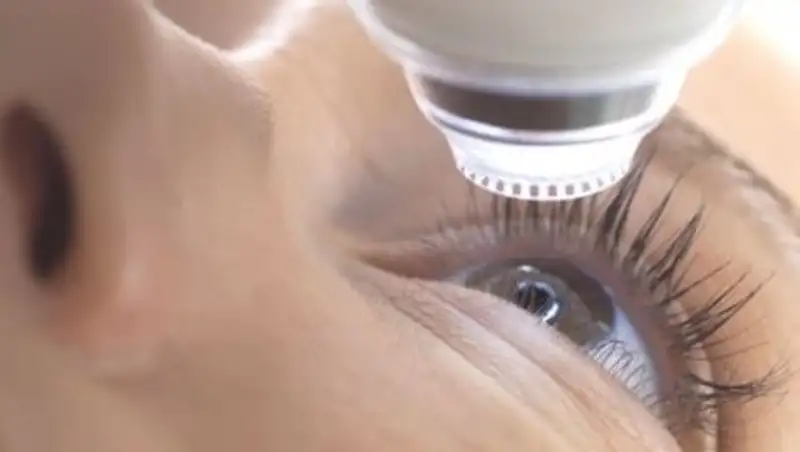 Лазерная коррекция: быстрый и эффективный способ восстановить зрение