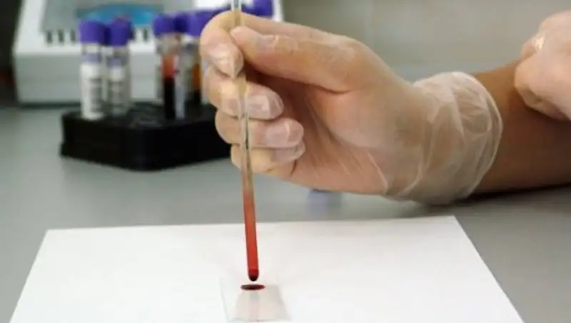 Обстановка по сибирской язве в ВКО стабильная