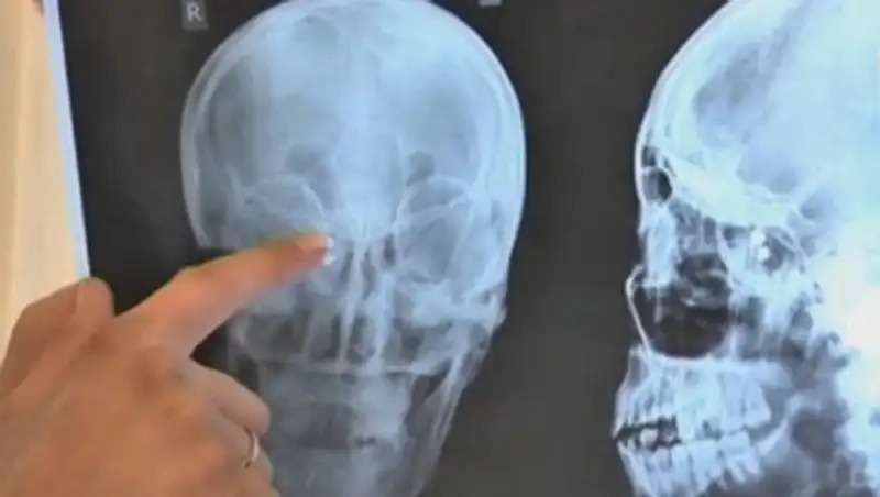 В ЮКО во время отлова бродячих собак подстрелили молодую женщину