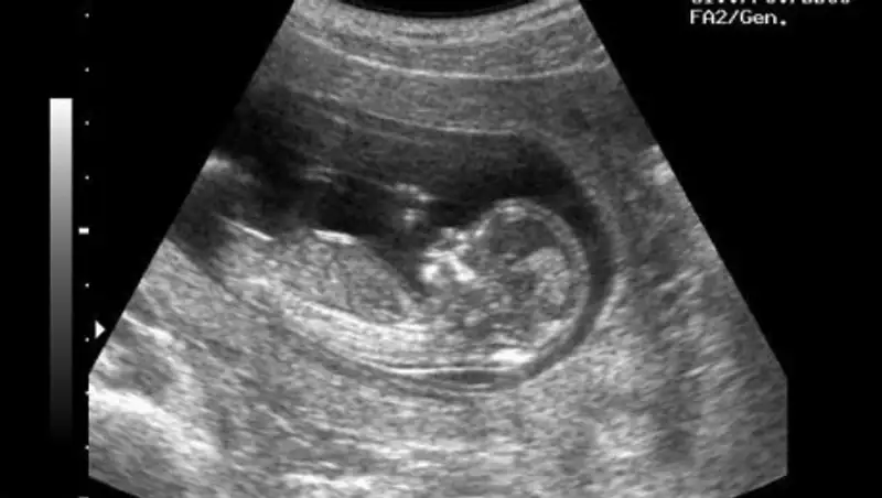 Жительница Атырау родила больного ребенка, посещая вместо врача целителя