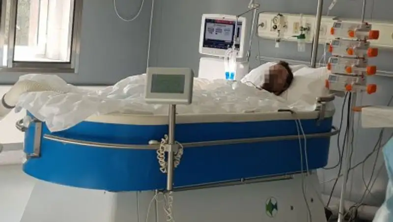 40% ожогов тела у работника, получившего удар током на улице в Алматы