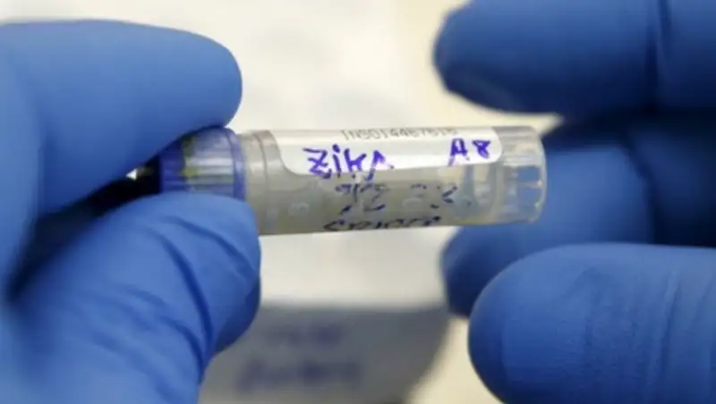 В США проверяют 14 возможных случаев заражения вирусом Зика через секс
