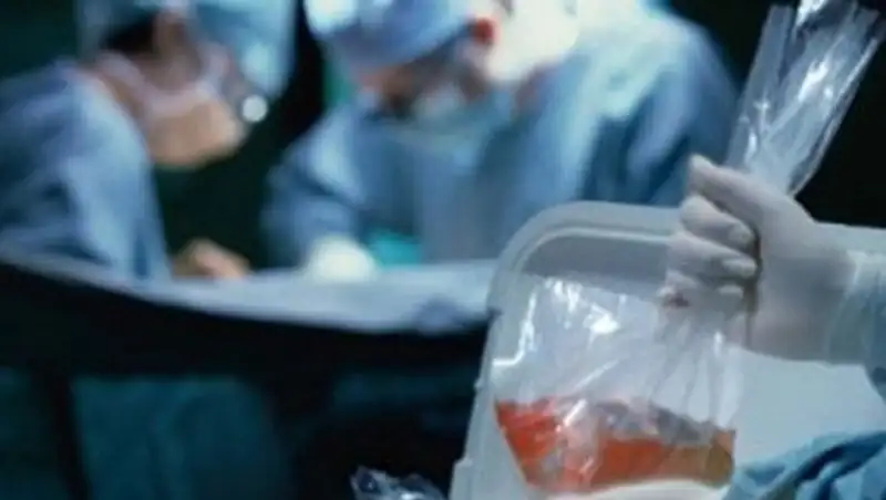 О необходимости трупного донорства говорят врачи и общественники ЮКО