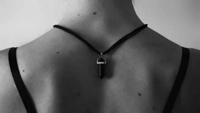 Врачи назвали первые признаки рака кожи